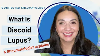 What is Discoid Lupus? A Rheumatologist explains