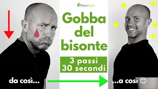 Gobba del bisonte: 3 facili step per eliminarla