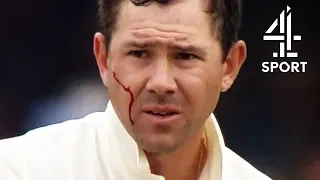 The Brutal Injuries of the Ashes | Ashes 2005: The Greatest Series