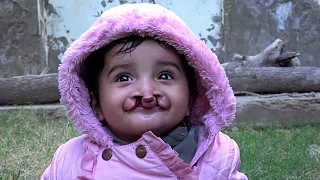 Cleft Mission Naushahro Feroz (Sindh) 14ht December 2023