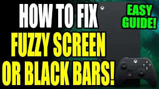 Xbox: How to Fix Fuzzy Screen or Black Bars! Xbox Series S/X Fuzzy Display or Black Bars Easy Fix!