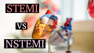 Myocardial Infarction Treatment: STEMI vs NSTEMI | ER Nurse Series