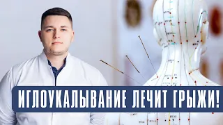 Иглоукалывание лечит грыжи! Подробно об иглорефлексотерапии.