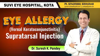 Eye Allergy (Vernal Keratoconjunctivitis) Supratarsal Injection Dr Suresh Pandey SuVi Eye Hosp. Kota