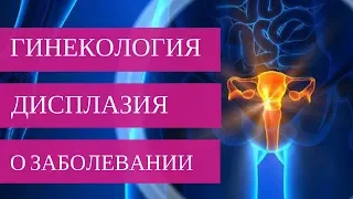 ДИСПЛАЗИЯ ШЕЙКИ МАТКИ - о заболевании | Добрый Прогноз