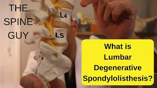 What is Lumbar Degenerative Spondylolisthesis - Part 1