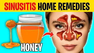 10 Home Remedies to Get Rid of Sinusitis