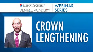 The No-Nonsense Guide to Simple & Complex Crown Lengthening