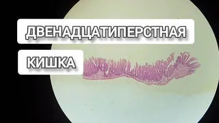 ДВЕНАДЦАТИПЕРСТНАЯ КИШКА