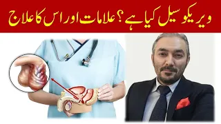 Varicocele Symptoms and Treatment | Varicocele ka ilaj in hindi/Urdu | Dr Fartash Sarwar