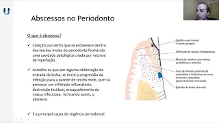 Video-aula de Afecções Agudas Periodontais gravada pelo prof. Otto Magro