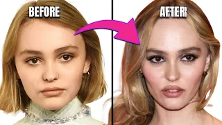 Has Plastic Surgery Prematurely Aged Lily Rose Depp?