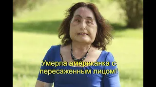 Умерла американка с пересаженным лицом!