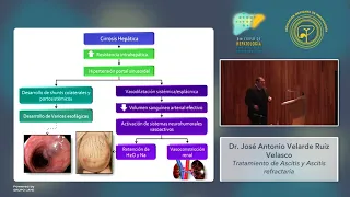 Módulo V - Tratamiento de ascitis y ascitis refractaria