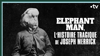Elephant Man, l'histoire tragique de Joseph Merrick - Culture Prime