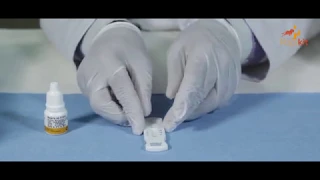 Rapikit Malaria Antibody Rapid Test Instructional Video