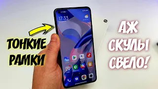 Купил НОВЫЙ XIAOMI 11 LITE 5G NE и АЖ СКУЛЫ СВЕЛО! 😱ТОНКИЕ РАМКИ - ТОП сяоми