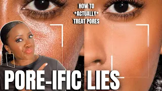 Actually, Do THIS to Treat Large Pores (Black Skin)