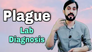 Plague Disease | Lab Diagnosis | Causes and Treatment