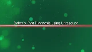 Bakers Cyst Diagnosis