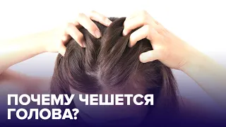 Почему ЧЕШЕТСЯ ГОЛОВА и как избавиться от ЗУДА?