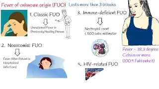 Fever of Unknown Origin (FUO) - Causes. Unexplained Fever,  Low grade fever