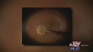 Video: Eye Cancer: Micro-Surgery