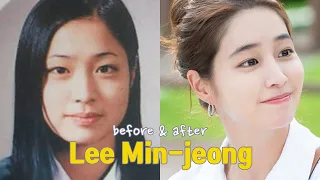 Lee Min-jeong before and after