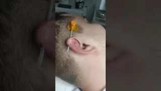 Пирсинг уха Индастриал. Indastrial  Piercing .Ученица.