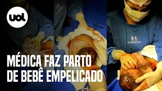 Médica faz parto raro de bebê empelicado em GO