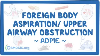 Foreign body aspiration / upper airway obstruction: Nursing Process