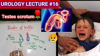 Urology surgery lecture #16 torsion of testis #testicular appendages #orchitis