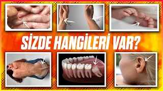 Bu Körelmiş Organların Kaç Tanesi Sizde Var?