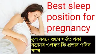 #pregnantWomanSleepPosition Right position to sleep in pregnancy গৰ্ভাৱস্থাত কিদৰে শুব লাগে