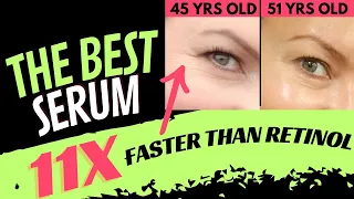 HOW TO LOOK 6 YEARS YOUNGER?! OVERNIGHT RESULTS!