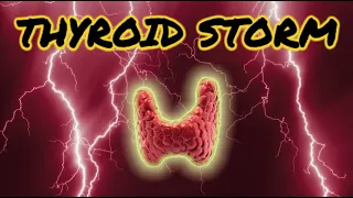 Thyroid Storm (updated 2023) - CRASH! Medical Review Series