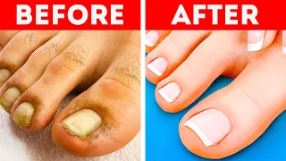 Brilliant Pedicure And Manicure Hacks You Need to Try