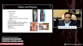A Multidisciplinary Approach to Screening and Managing Peripheral Arterial Disease