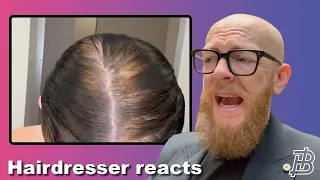 She is BLEACHING her hair with BOX BLEACH !!! Hairdresser Reacts to Hair Fails