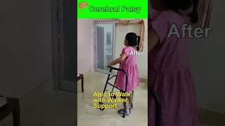 Revolutionary Cell Therapy from Bangladesh Cerebral Palsy Diagnosis Walking with Walker Support