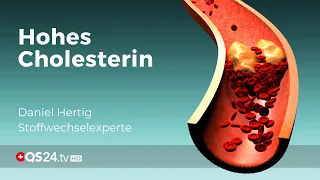 Hohe Cholesterinwerte und ihre Ursache | Stoffwechselexperte Daniel Hertig | QS24