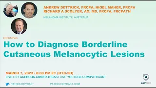 #DERMPATH How to Diagnose Borderline Cutaneous Melanocytic Lesions