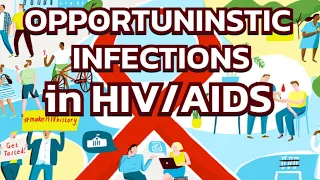 Opportunistic Infections in HIV/AIDS (updated 2023) - CRASH! Medical Review Series