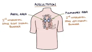 Heart Murmurs and Heart Sounds: Visual Explanation for Students