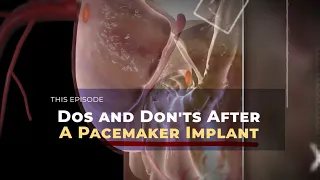 Dos and Don'ts After A Pacemaker Implant