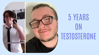 5 YEARS ON TESTOSTERONE | 21 YEARS OLD | FTM