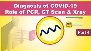 qPCR, RT-PCR & Real-Time PCR - Polymerase Chain Reaction in Coronavirus (COVID-19) Diagnosis