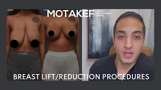 Breast Lift + Breast Reduction: What to expect (case study) - MOTAKEF PLASTIC SURGERY