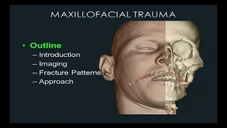 Face Trauma CT - [Emergency Radiology]