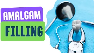What is an Amalgam Filling (4 Advantages and Disadvantages)